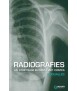 Radiografies. Un striptease en vint-i-un contes
